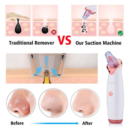 Blackhead Instrument Electric Suction Facial Washing Instrument Beauty Acne Cleaning Blackhead Suction Instrument